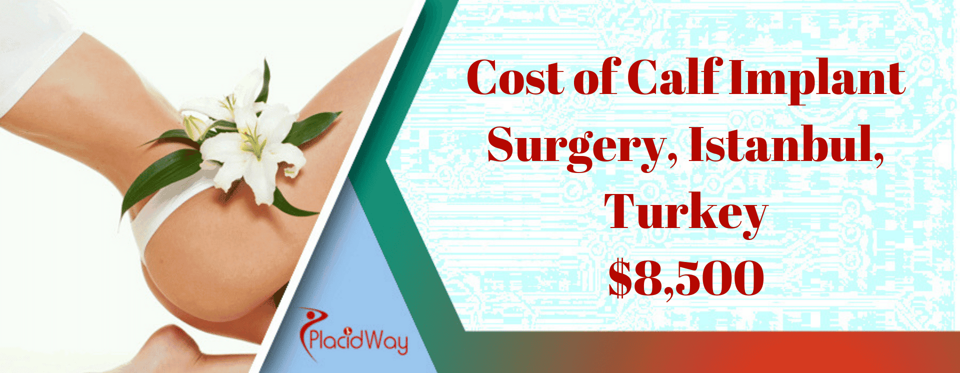 Cost of Calf Implant Surgery in Istanbul, Turkey
